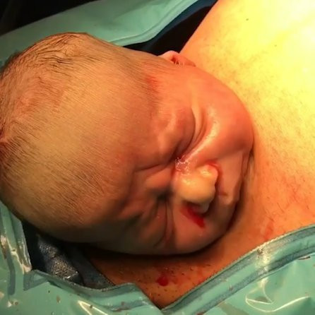 Bu anı gören doktorlar oradan kaçtı bebek bekleyemedi - Resim: 4