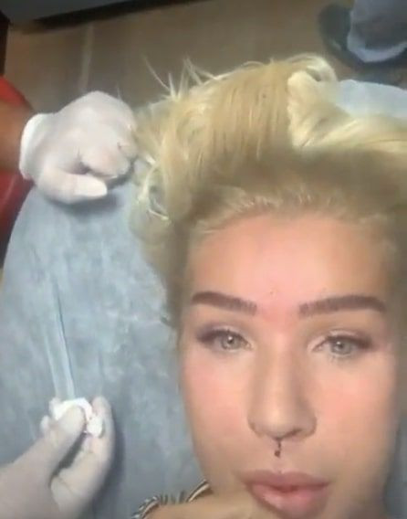 Seda Sayan estetik yaptırdığı anları paylaştı! Bu kez dudağını kaldırttı - Resim: 3