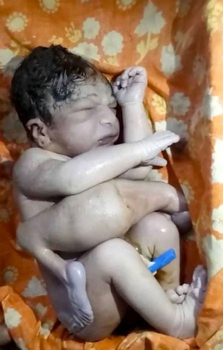 Bebek bu halde doğdu ailesi onu korkunç şekilde öldürmek istedi  - Resim: 3