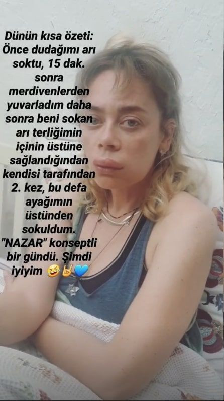 Demet Evgar'ın son halini gören şaştı kaldı botoks yaptırdım deyip anlattı - Resim: 3