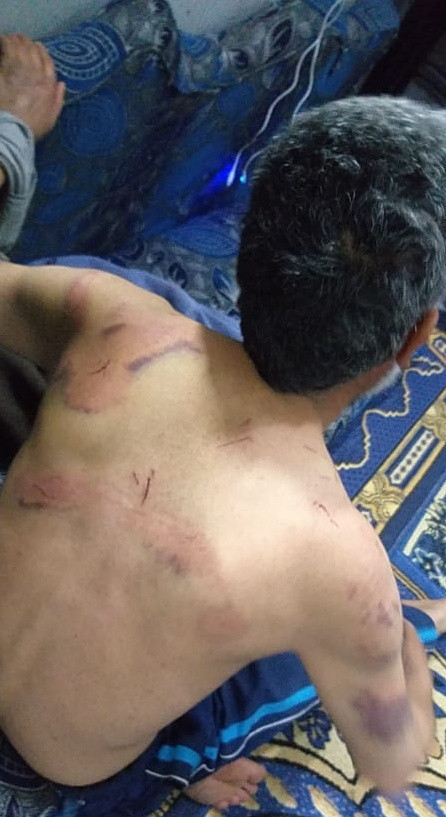 Suriye'de PKK işkencesinde böbreği çalışamaz hale geldi! Suçu da üzerlerine attılar - Resim: 0