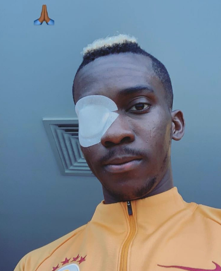 Galatasaraylı Onyekuru darbe aldığı gözünü paylaştı - Resim: 0