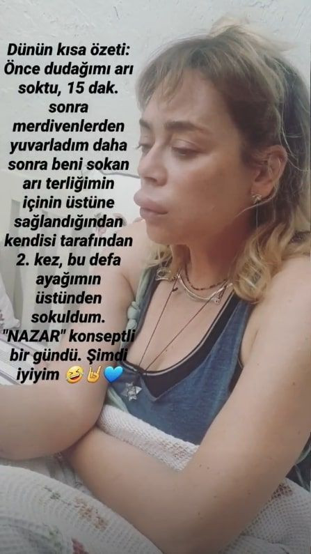 Demet Evgar'ın son halini gören şaştı kaldı botoks yaptırdım deyip anlattı - Resim: 2