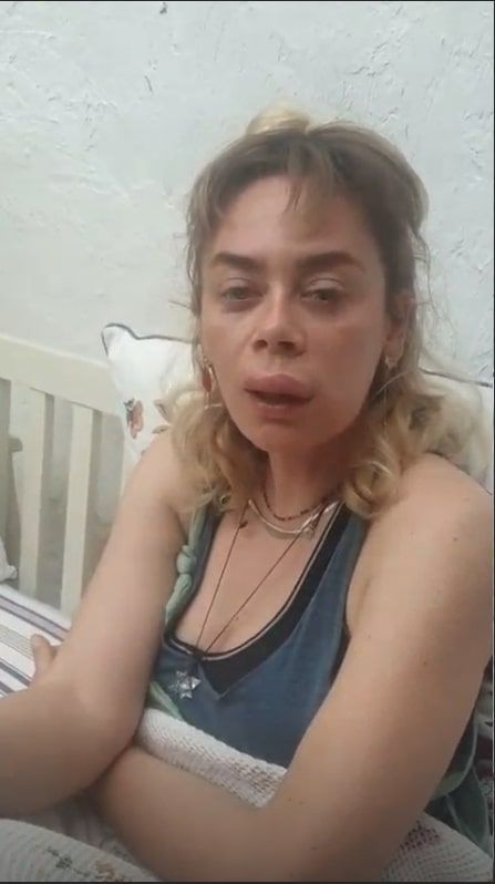 Demet Evgar'ın son halini gören şaştı kaldı botoks yaptırdım deyip anlattı - Resim: 4