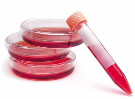 Bu kan grubuna sahip olanlar dikkat! - Resim: 4