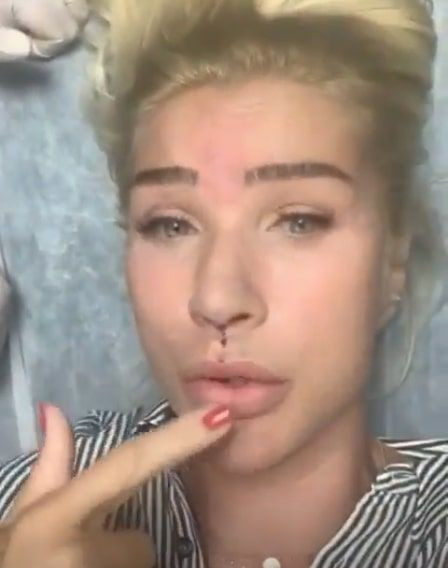 Seda Sayan estetik yaptırdığı anları paylaştı! Bu kez dudağını kaldırttı - Resim: 2