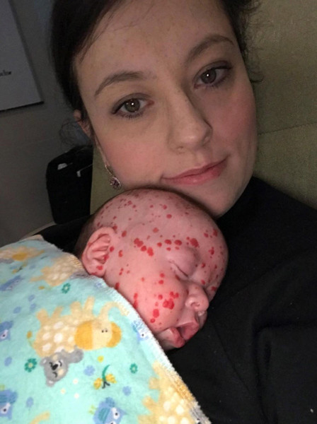 Doktorları bile hayrete düşürdü görenler korkup kaçıyor ama... - Resim: 3