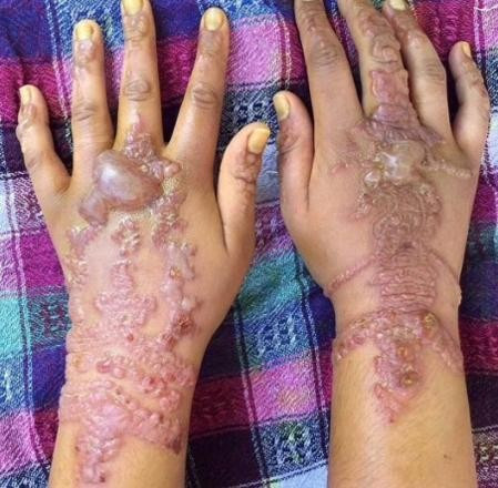 Ellerine dövme yaptırdı ama bu halde geldi korkunç görüntü! - Resim: 2