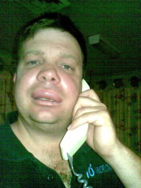 Arı sokması moda oldu! - Resim: 2