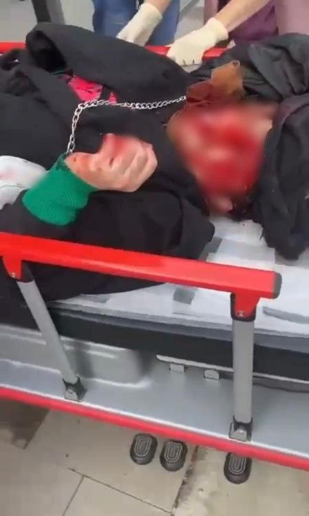 Dini nikahlı eşi sokak ortasında bıçakladı yüzü paramparça olan kadın konuştu - Resim: 4