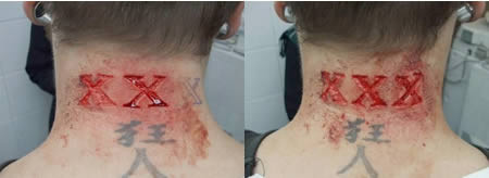 Bunları güzelleşmek uğruna yapıyorlar - Resim: 2