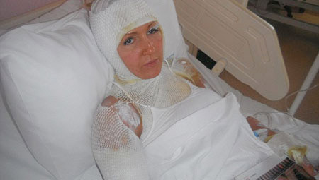 Dünya bu dehşeti konuşuyor! - Resim: 4