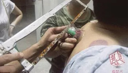 Cinsel organını yıldız anahtarına sıkıştırdı itfaiye seferber oldu - Resim: 3