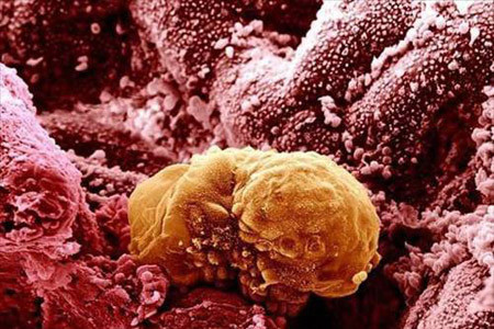 İnsan vücudundan 15 muhteşem görüntü - Resim: 4