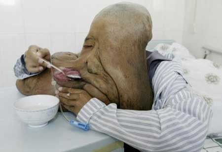 Yüzünde 23 KİLO UR var! - Resim: 3