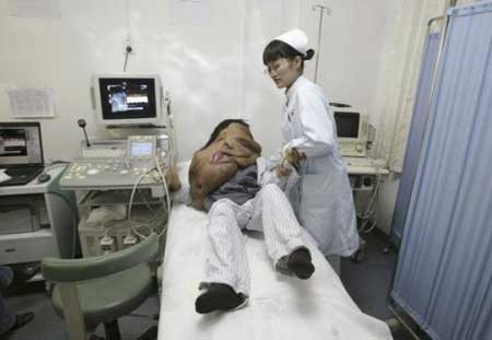 Yüzünde 23 KİLO UR var! - Resim: 4