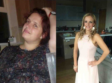 Bu değişime inanamayacaksınız! Kilo verince.. - Resim: 4