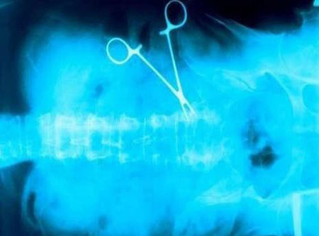 İnanılmaz röntgen filmleri - Resim: 1