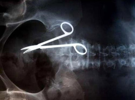 İnanılmaz röntgen filmleri - Resim: 2