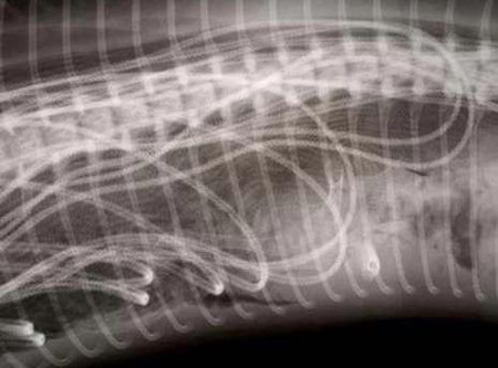 İnanılmaz röntgen filmleri - Resim: 3
