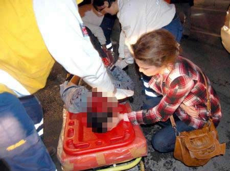 Sevgilisinin başından ayrılmadı - Resim: 2