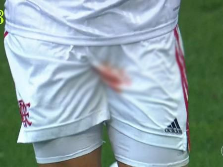 Futbol dünyası böyle sakatlık görmedi! Gözyaşlarıyla oyundan çıktı - Resim: 4