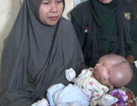 Dünya onları konuşuyor! İki yüzle doğdular  - Resim: 2