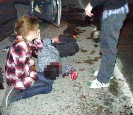 Sevgilisinin başından ayrılmadı - Resim: 1