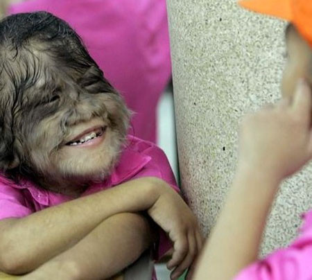 Dünyanın en tuhaf hastalıkları - Resim: 1