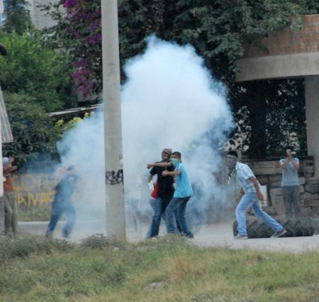 Yaptığı bomba elinde patladı - Resim: 4