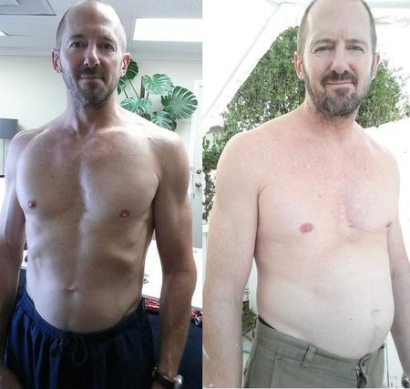 Günde 10 kola içen adamın son hali - Resim: 1