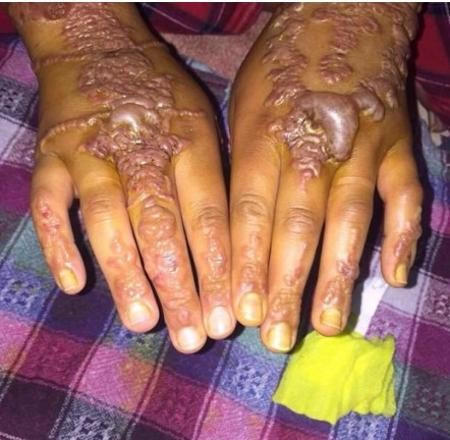 Ellerine dövme yaptırdı ama bu halde geldi korkunç görüntü! - Resim: 4