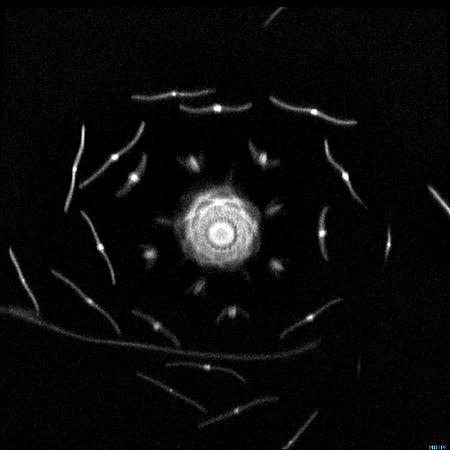 Bu hareketli MR görüntüleri şaşırtıyor - Resim: 2