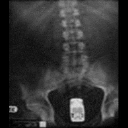 İnsanların içinden neler çıktı! - Resim: 2