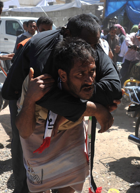 Bunlar da dünyanın bugün tıkladıkları - Resim: 2