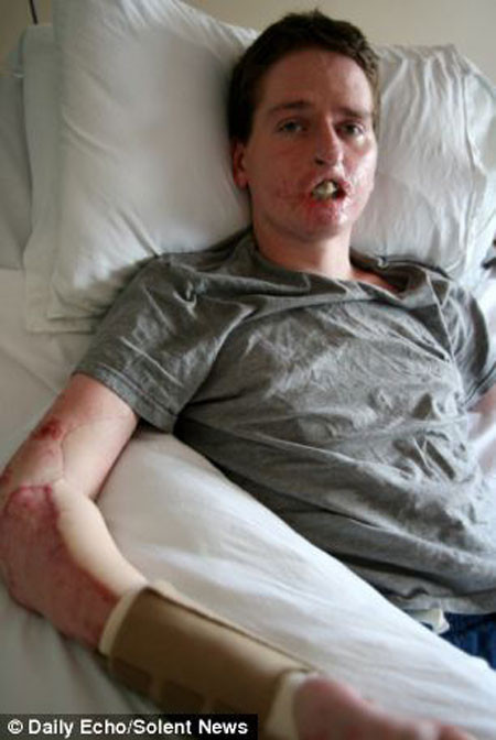 Soğuk algınlığı zannettiği hastalık hayatını kararttı - Resim: 2