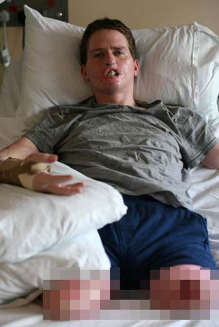 Soğuk algınlığı zannettiği hastalık hayatını kararttı - Resim: 4