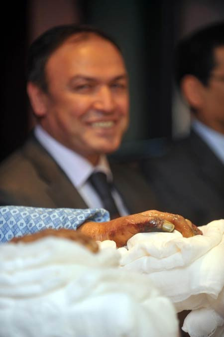 Nakilden sonra ilk kez medya karşısında - Resim: 2