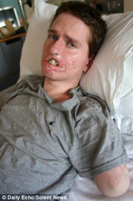 Soğuk algınlığı zannettiği hastalık hayatını kararttı - Resim: 3