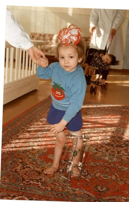 8 yaşında annesi bacaklarını aldırttı inanılmaz olay! - Resim: 1