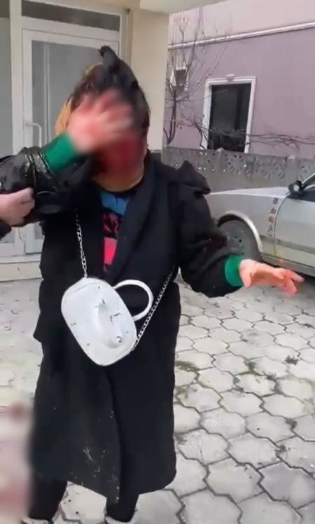 Dini nikahlı eşi sokak ortasında bıçakladı yüzü paramparça olan kadın konuştu - Resim: 3