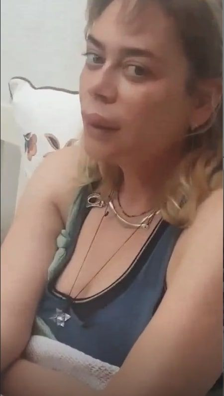 Demet Evgar arı botoksu oldu! Merdivenlerden de yuvarlanınca... - Resim: 1