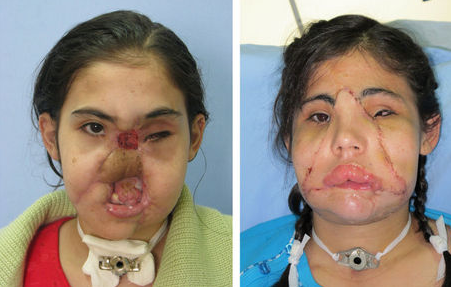 Yeni yüz yeni hayat - Resim: 2