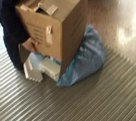 Türkiye'de 2. yüz nakli başladı! - Resim: 3