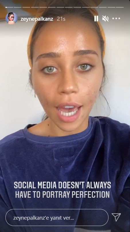 Hamdi Alkan'ın kızı Zeynep Alkan yüzündeki sivilceleri paylaşarak isyan etti! - Resim: 2