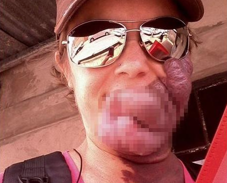 'İnsan yiyici' diye dalga geçiyorlardı! Büyük değişim yaşadı - Resim: 1