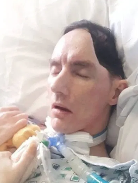 Beyzbol sopalı saldırı hayatını kararttı! Kafasının yarısı alındı - Resim: 4