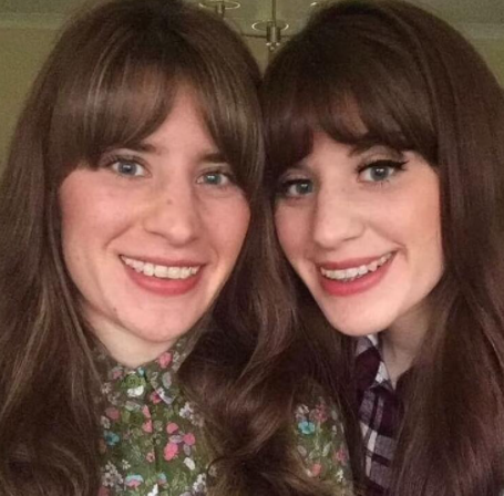 Dünya ikiz kardeşleri konuşuyor! Meksika tatili feci bitti: Timsahla çıplak elle savaştı - Resim: 3