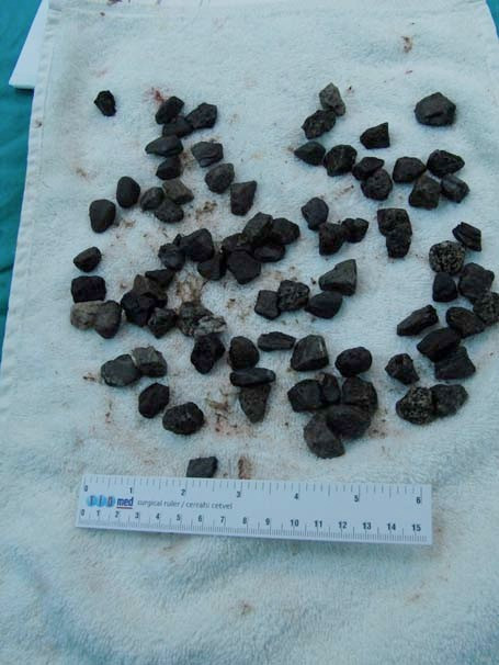 Midesinden sesler gelince doktorlar gözlerine inanamadı - Resim: 2