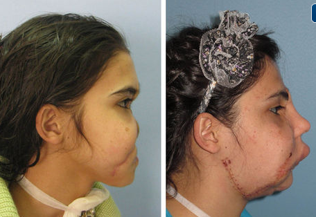 Yeni yüz yeni hayat - Resim: 3